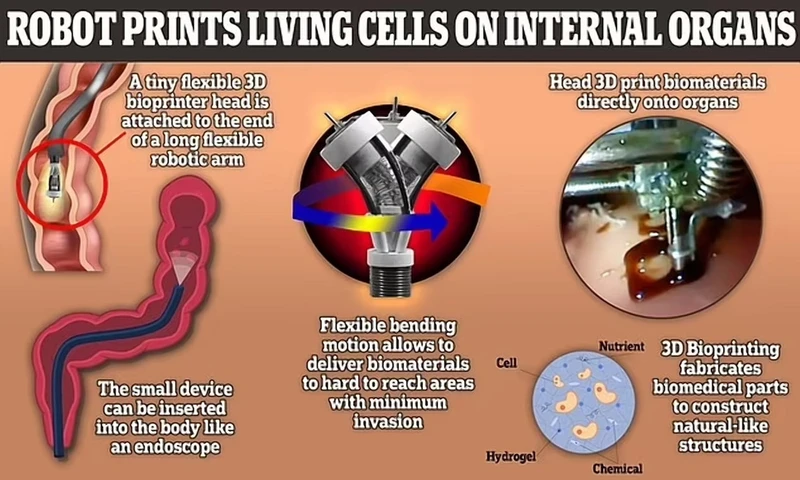 Surgeon without a scalpel: a robot has been created that prints cells for internal organs.