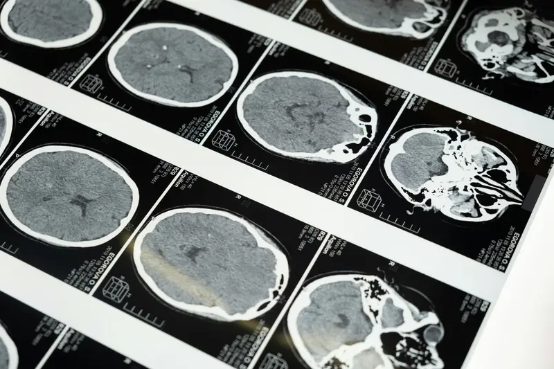 AI distinguishes between the brains of men and women with 90 percent accuracy.
