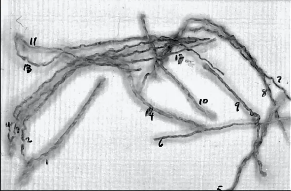 Breaking news: Italian scientists have determined the age of the Shroud of Turin.