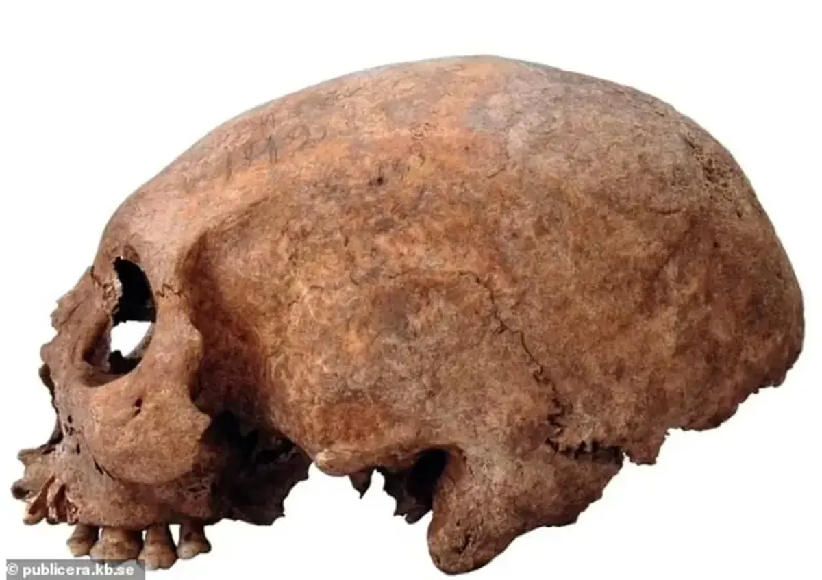 Viking Age Plastics: Remains of Women with Abnormally Long Skulls Discovered