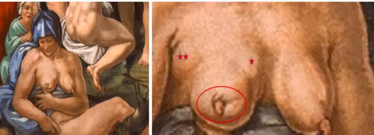 The secret of the Sistine Chapel: a woman in Michelangelo's fresco has been diagnosed with a terminal illness.