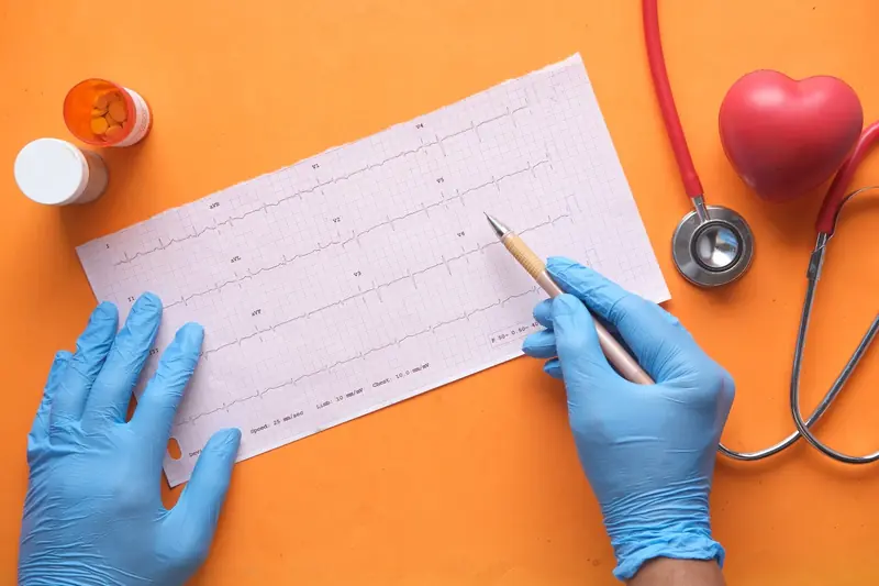 Electrocardiogram along with a shopping cart.