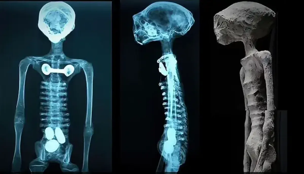 Archaeologists have discovered mummies in Egypt with golden tongues and nails.