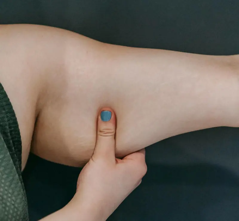 Excess fat in the arms is linked to a higher likelihood of dementia.