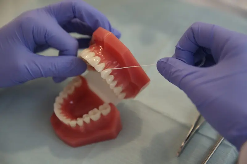 The flossing effect: a simple hygiene habit reduces the risk of stroke.