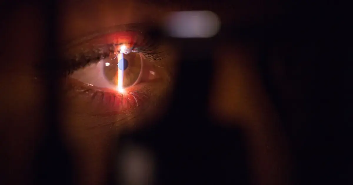 Not just carrots: Expert names the most important foods for eye health
