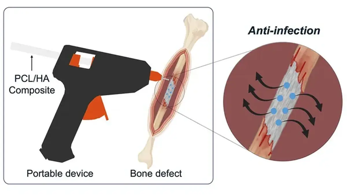 Glue gun for 3D printing bones