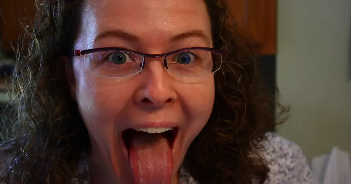 The 'Map' of the Body: Why Doctors Examine the Tongue