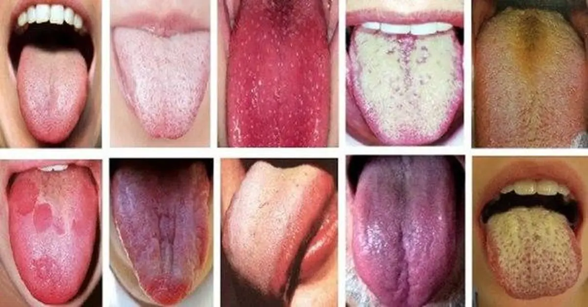 Various Tongue Colors