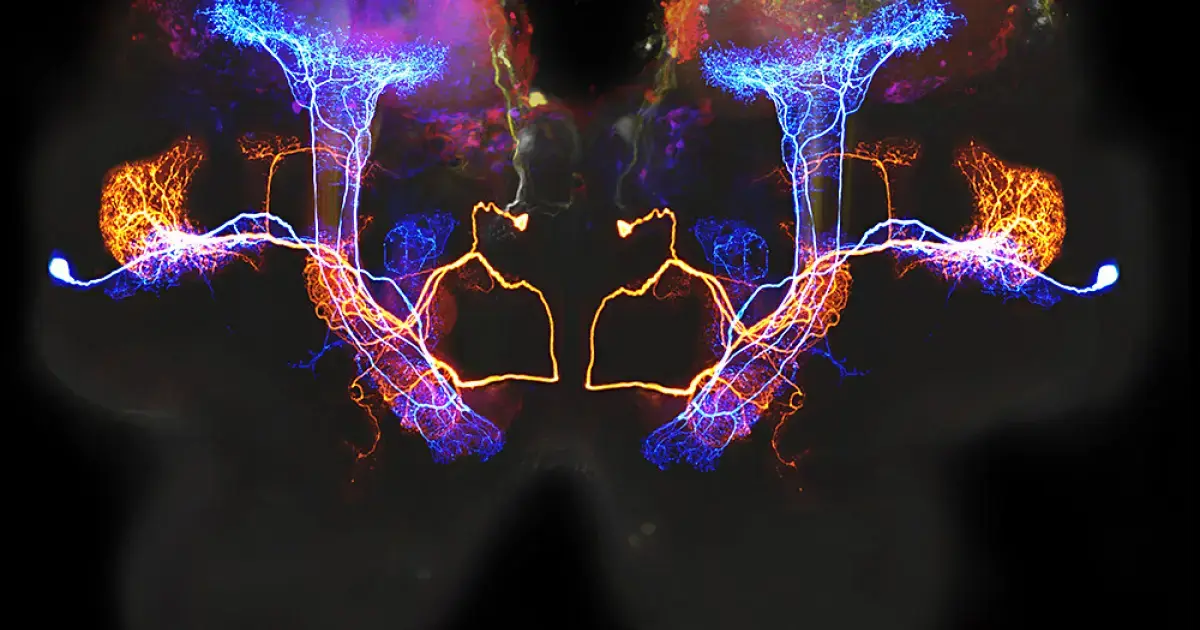 Harmful proteins in people with dementia may begin to accumulate in the part of the brain responsible for smell