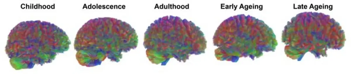 Five Key Epochs of Brain Development