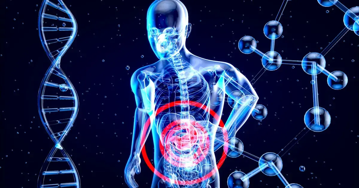 Irritable bowel syndrome