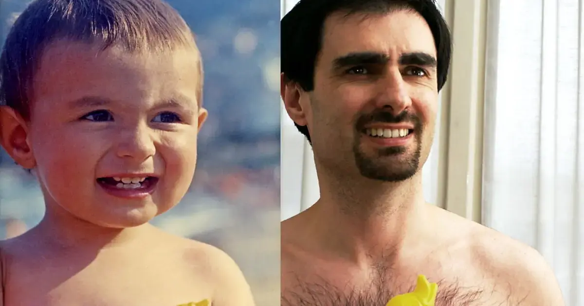 Body hair on a boy and a man